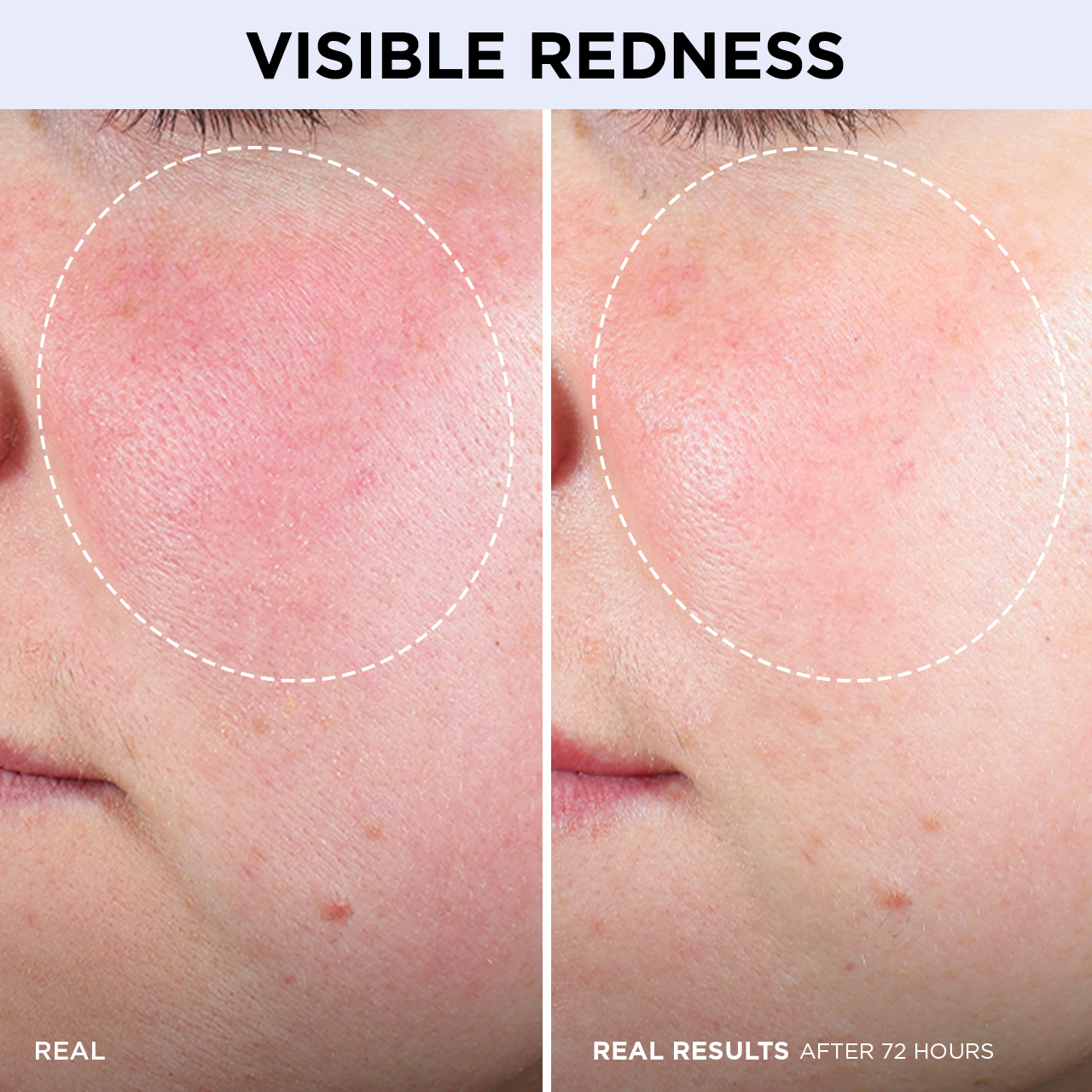 CONFIDENCE IN A CREAM BARRIER BOOST (CREMA HIDRATANTE PARA ROSTRO)